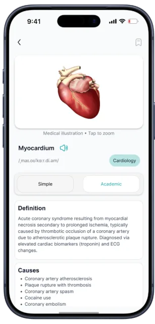 MedLex term page for Myocardium with an illustration, pronunciation and a Simple / Academic switch